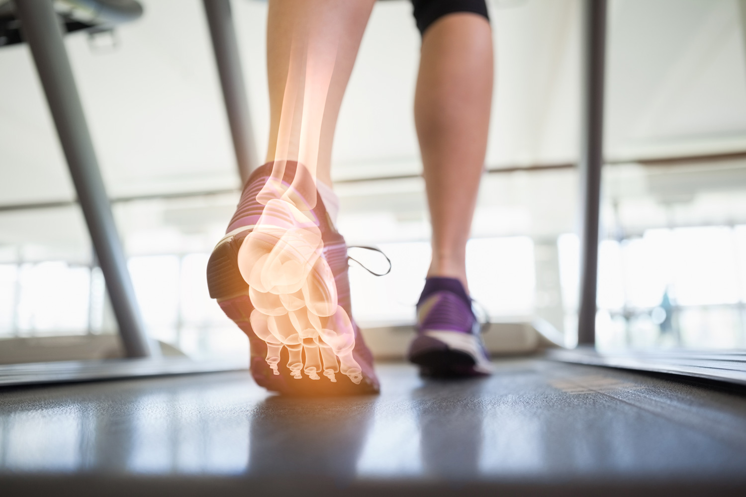 Skeleton structures in foot highlighted over someone walking on a machine